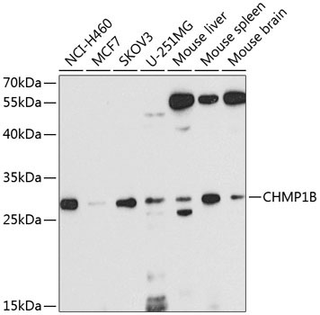 CHMP1B Rabbit Polyclonal Antibody