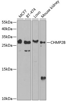 CHMP2B Rabbit Polyclonal Antibody