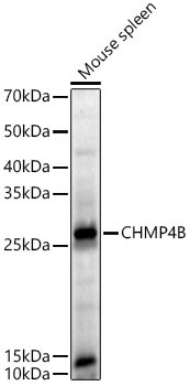 CHMP4B Rabbit Polyclonal Antibody