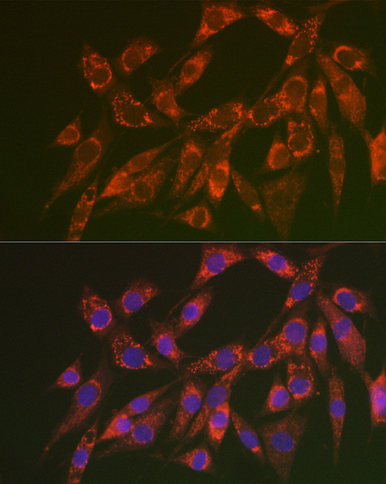 CHMP4B Rabbit Polyclonal Antibody - Image 2