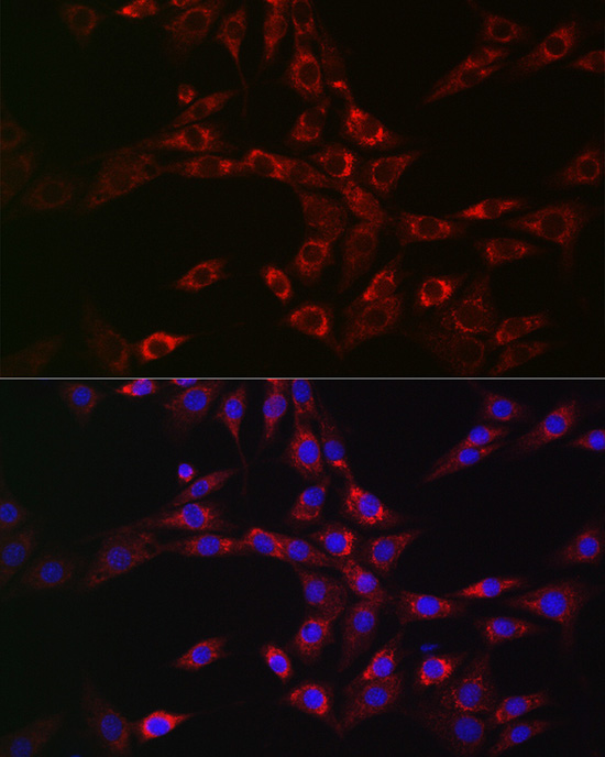 CHMP6 Rabbit Polyclonal Antibody - Image 2