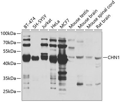 CHN1 Rabbit Polyclonal Antibody