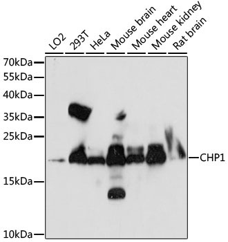 CHP1 Rabbit Polyclonal Antibody