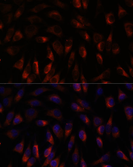 CHP1 Rabbit Polyclonal Antibody - Image 2