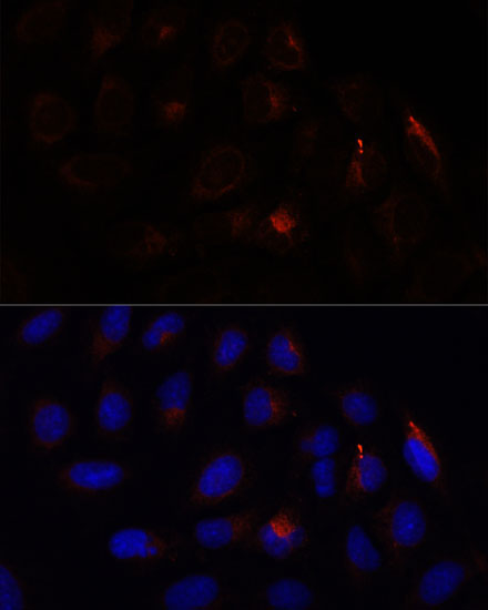 CHP1 Rabbit Polyclonal Antibody - Image 3