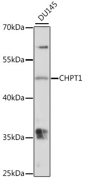 CHPT1 Rabbit Polyclonal Antibody