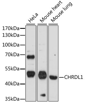 CHRDL1 Rabbit Polyclonal Antibody