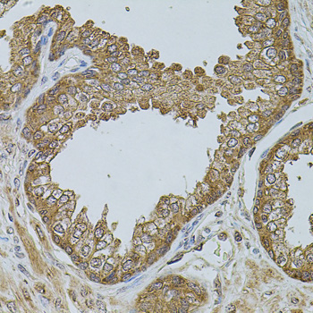 CHRFAM7A Rabbit Polyclonal Antibody - Image 2