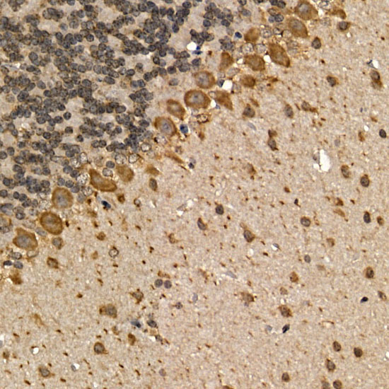 CHRM1 Rabbit Polyclonal Antibody - Image 2