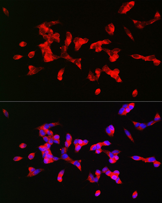 CHRM1 Rabbit Polyclonal Antibody - Image 4