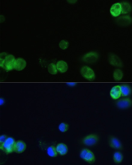 CHRM1 Rabbit Polyclonal Antibody - Image 2