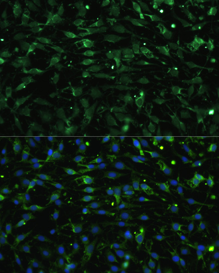 CHRM1 Rabbit Polyclonal Antibody - Image 3