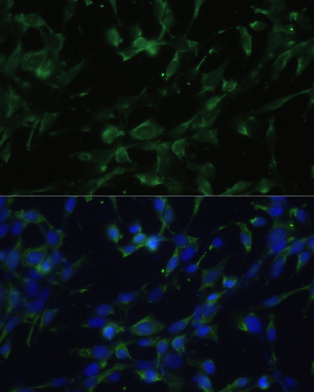 CHRM1 Rabbit Polyclonal Antibody - Image 4