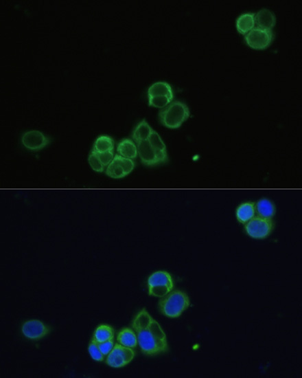 CHRM1 Rabbit Polyclonal Antibody - Image 5