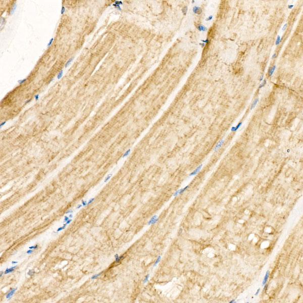 CHRNA1 Rabbit Polyclonal Antibody - Image 2