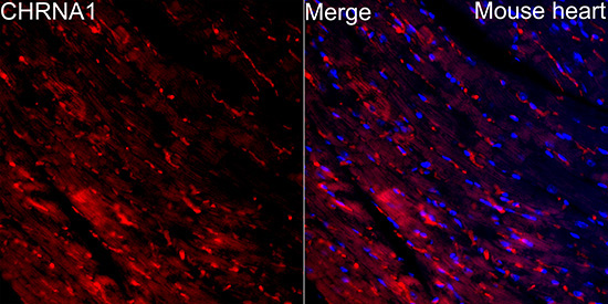 CHRNA1 Rabbit Polyclonal Antibody - Image 3