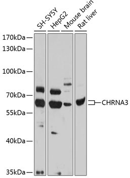 CHRNA3 Rabbit Polyclonal Antibody