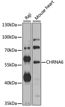 CHRNA6 Rabbit Polyclonal Antibody