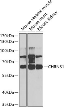 CHRNB1 Rabbit Polyclonal Antibody
