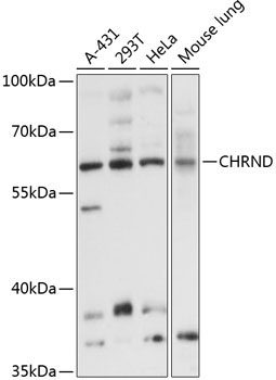 CHRND Rabbit Polyclonal Antibody