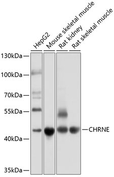 CHRNE Rabbit Polyclonal Antibody