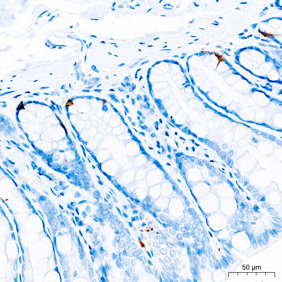 Chromogranin A Rabbit Monoclonal Antibody