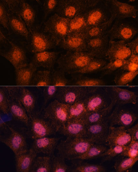 CHTF18 Rabbit Polyclonal Antibody - Image 2