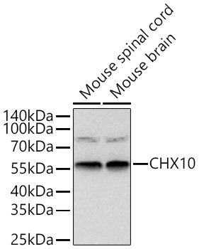 CHX10 Rabbit Monoclonal Antibody