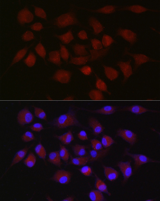 cIAP2 Rabbit Polyclonal Antibody - Image 3