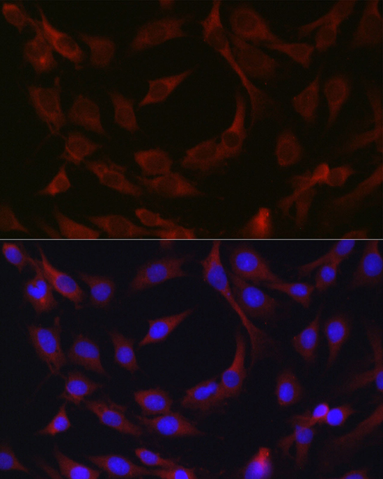 cIAP2 Rabbit Polyclonal Antibody - Image 4
