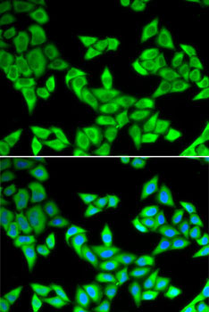 CIAPIN1 Rabbit Polyclonal Antibody - Image 2