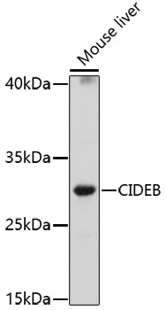 CIDEB Rabbit Polyclonal Antibody