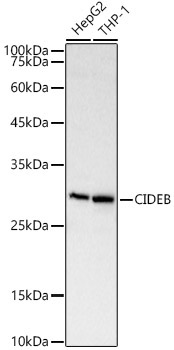 CIDEB Rabbit Polyclonal Antibody