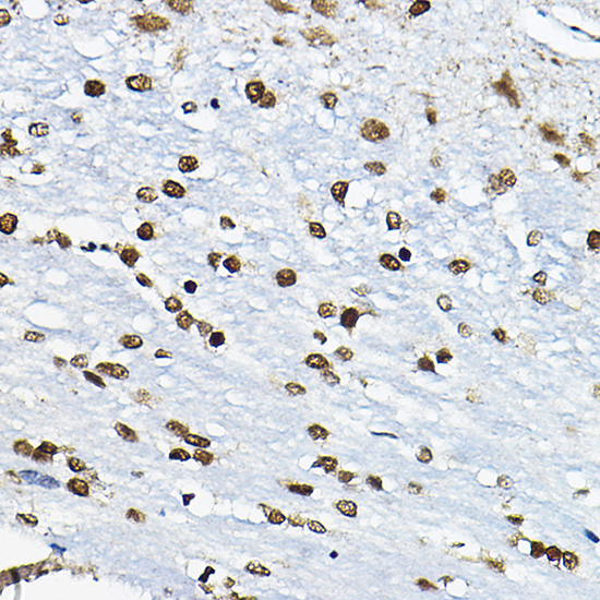 CIRBP Rabbit Polyclonal Antibody - Image 2