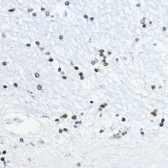 CIRBP Rabbit Polyclonal Antibody - Image 3