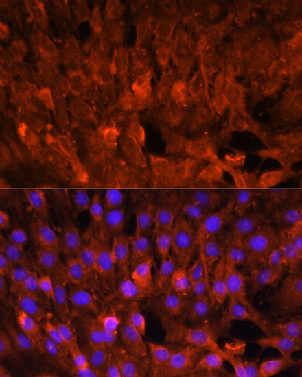 CISH Rabbit Polyclonal Antibody - Image 2