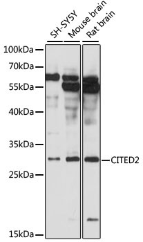 CITED2 Rabbit Polyclonal Antibody