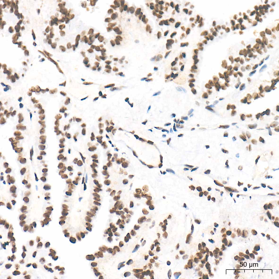 citrulline-Histone H3-R2/R8/R17 Rabbit Polyclonal Antibody - Image 3