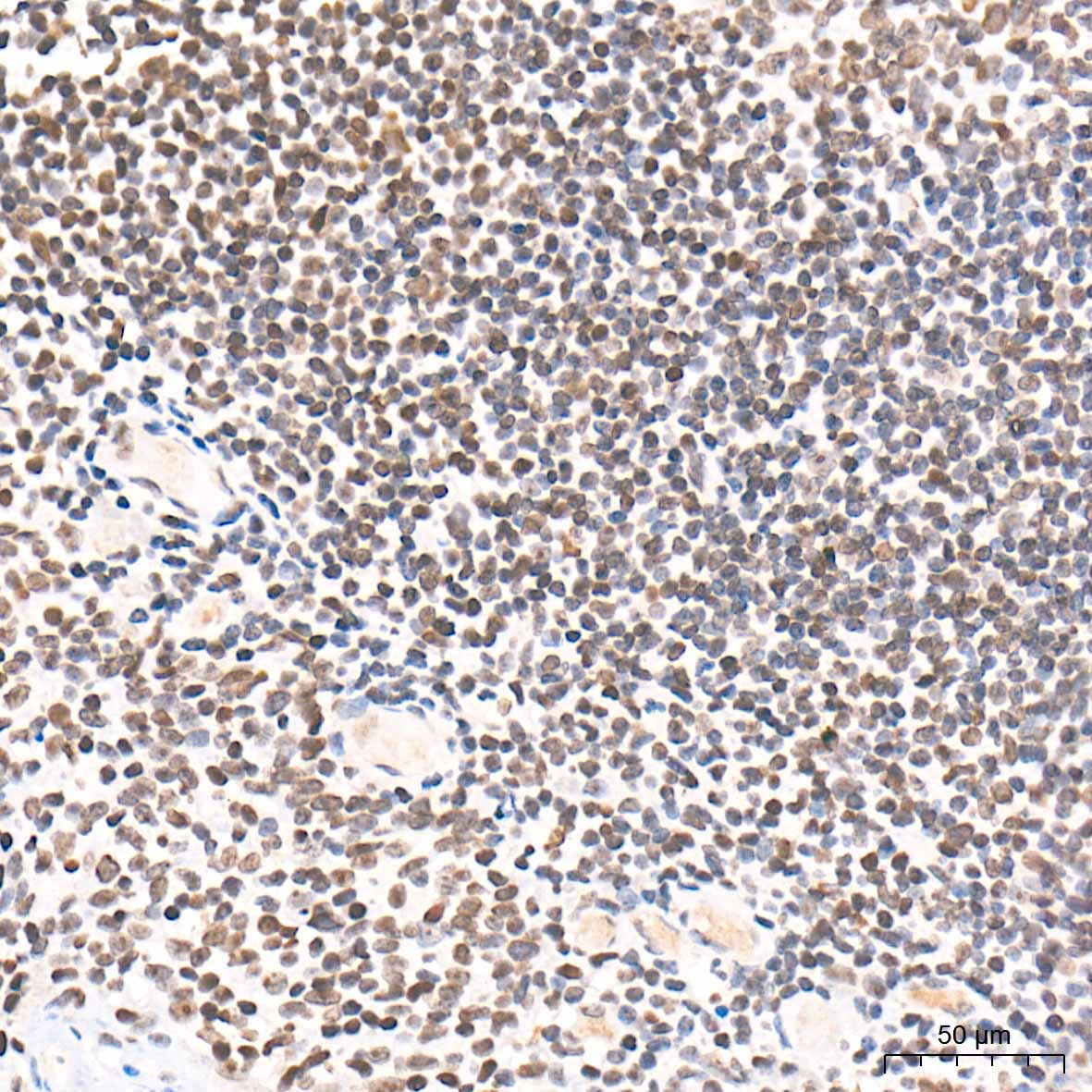 citrulline-Histone H3-R2/R8/R17 Rabbit Polyclonal Antibody - Image 4