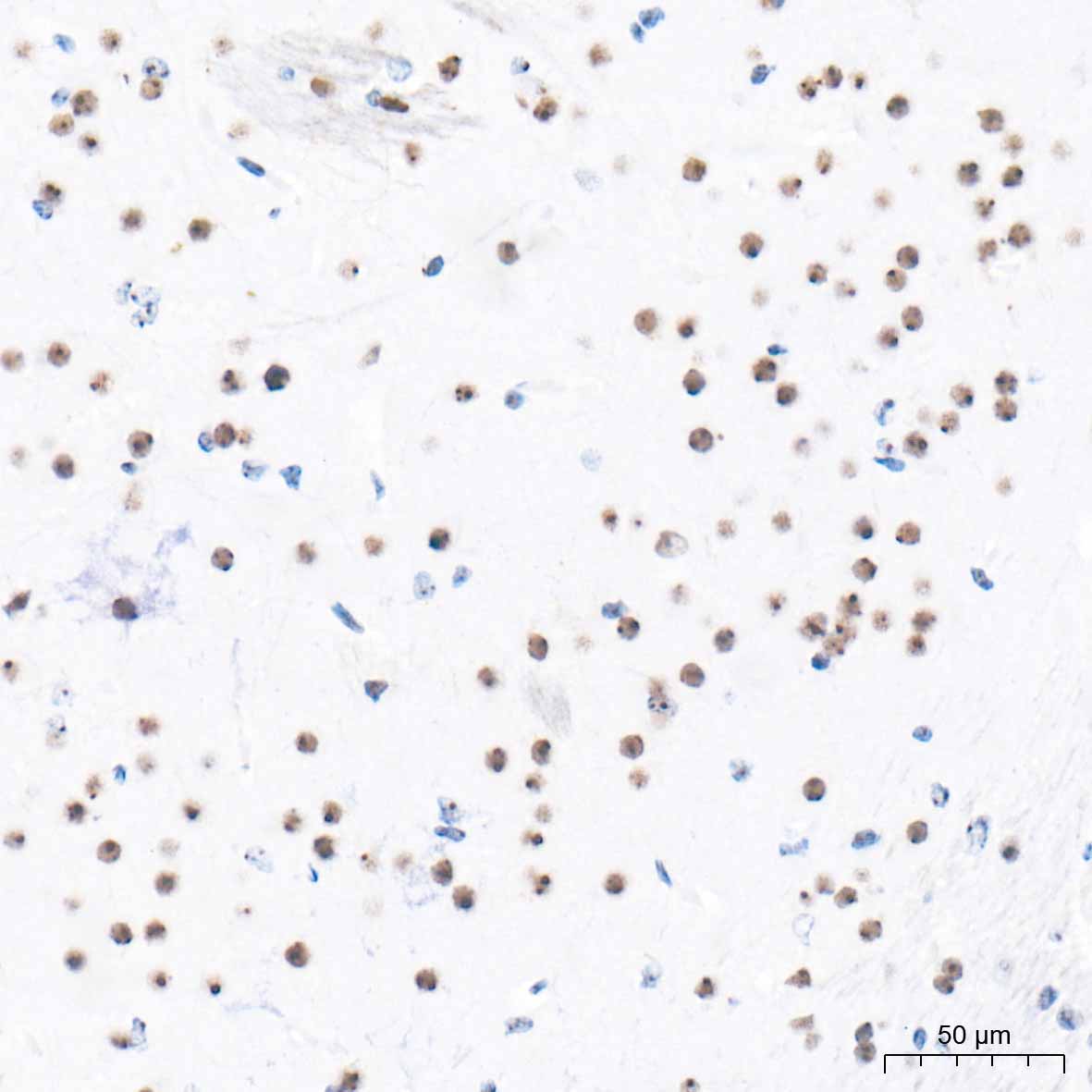 citrulline-Histone H3-R2/R8/R17 Rabbit Polyclonal Antibody - Image 5