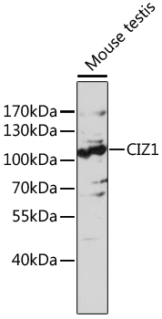 CIZ1 Rabbit Polyclonal Antibody