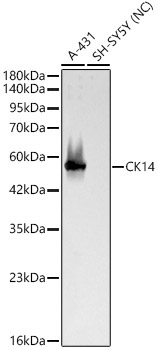 CK14 Rabbit Polyclonal Antibody