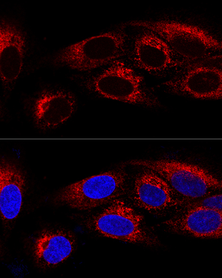 CKAP4 Rabbit Polyclonal Antibody - Image 2