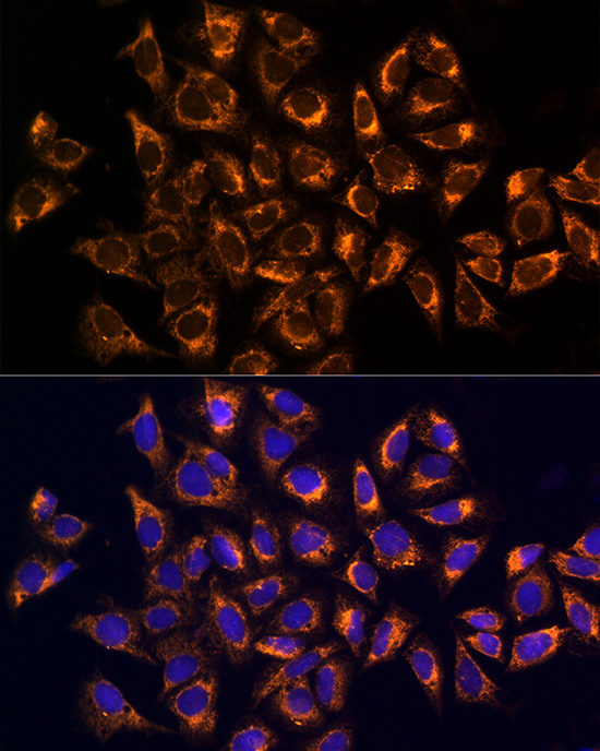 CKAP4 Rabbit Polyclonal Antibody - Image 3