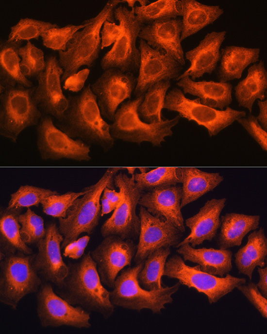 CKAP5 Rabbit Polyclonal Antibody - Image 2