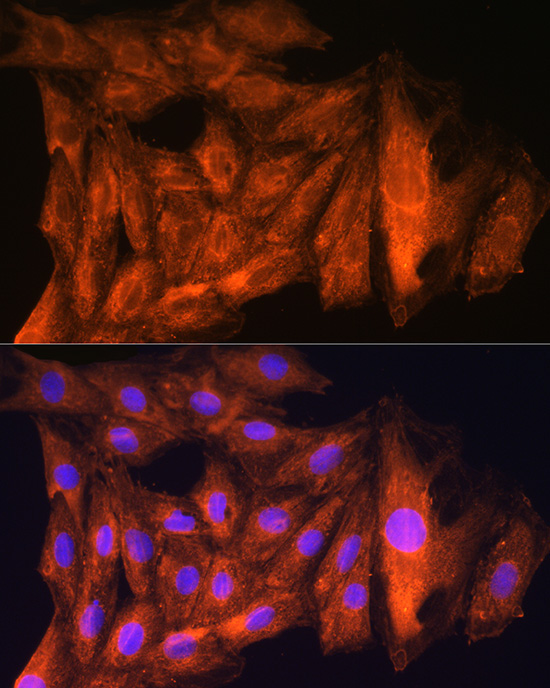CKAP5 Rabbit Polyclonal Antibody - Image 3