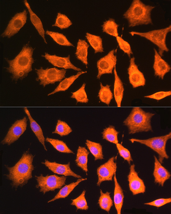 CKAP5 Rabbit Polyclonal Antibody - Image 4