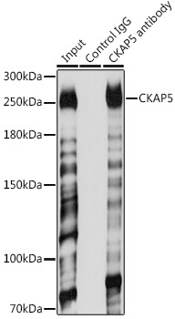 CKAP5 Rabbit Polyclonal Antibody - Image 5