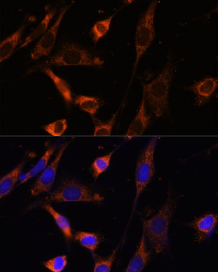 CKMT1B Rabbit Polyclonal Antibody - Image 2