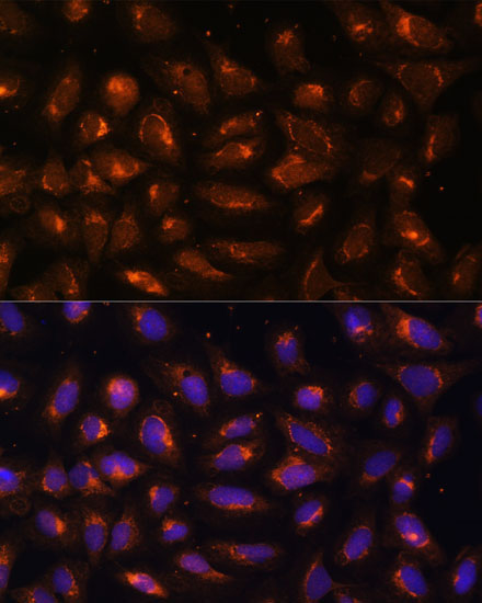 CKMT1B Rabbit Polyclonal Antibody - Image 3